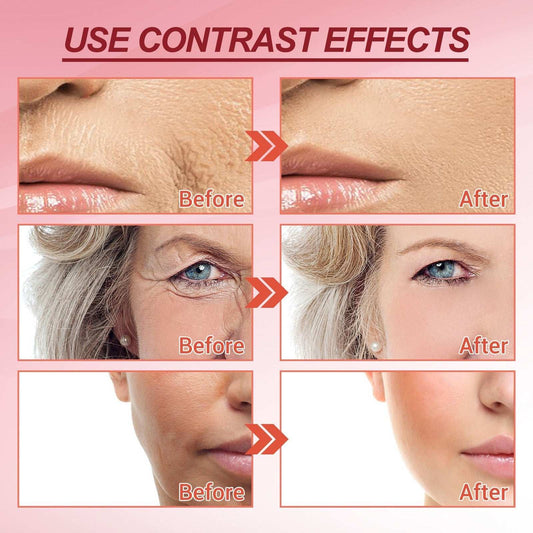 Before and after contrast showing skin improvement with Retinol Compact Face Cream.