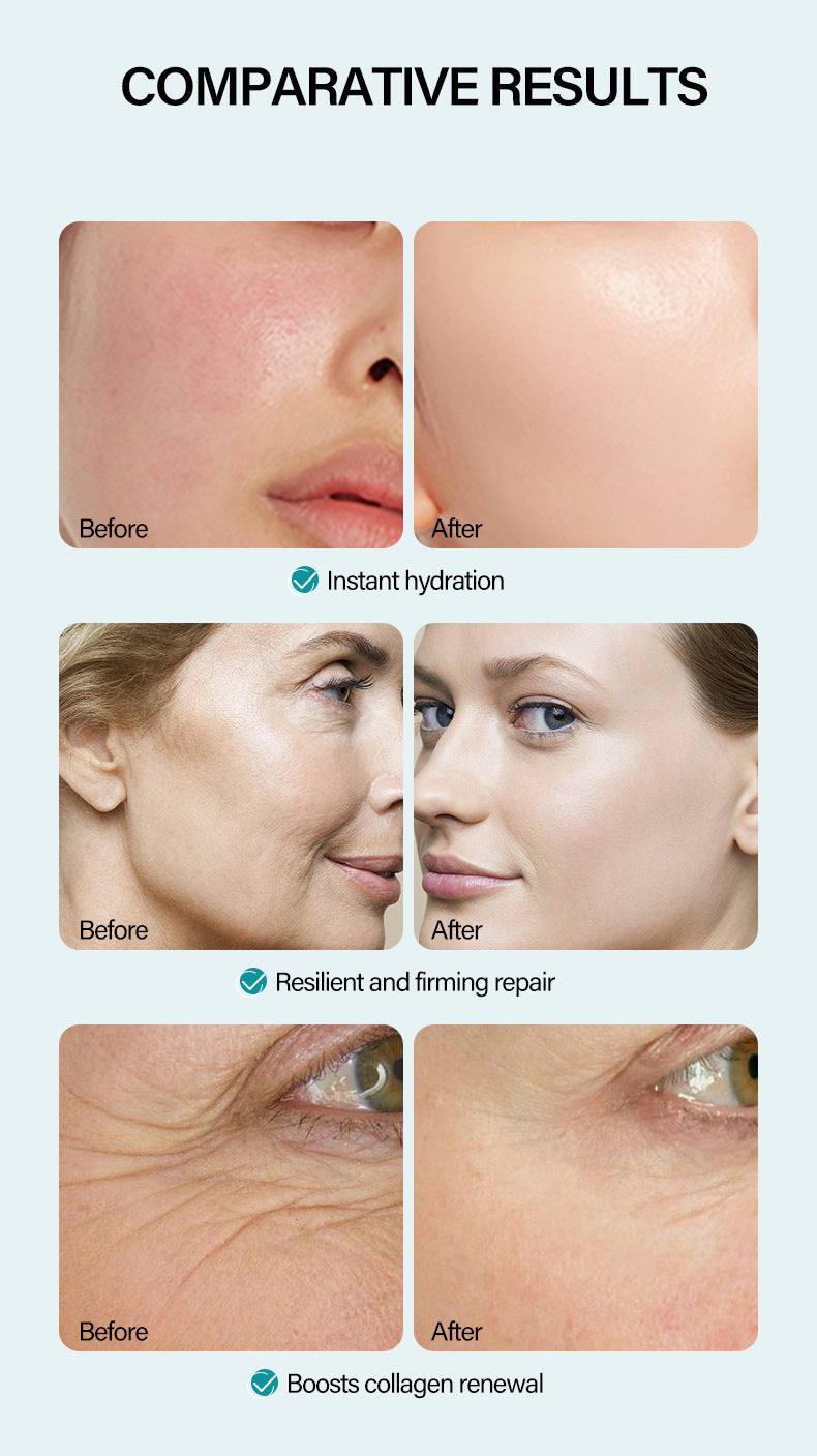 Comparative results showing the effects of anti-wrinkle face cream with hyaluronic acid on skin hydration and firming.