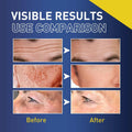 Visible results comparison of anti-aging face cream use, showcasing reduced wrinkles and faded spots before and after application.