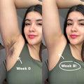 Before and after image of underarm hair removal using 5minSkin laser handset; visible hair reduction from week 0 to week 8-Vividbella