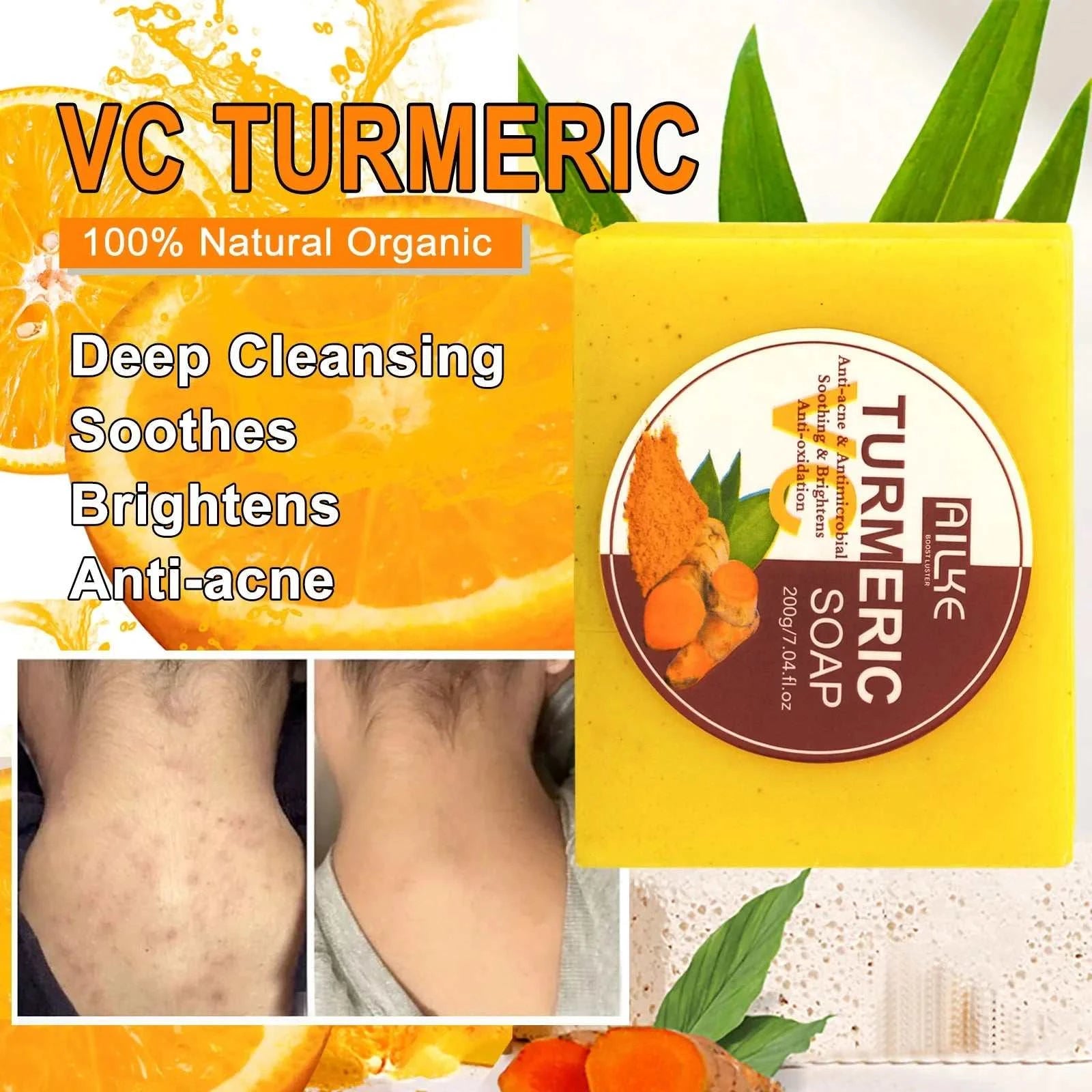 AILKE Organic Turmeric Skin Care Set, Brighten, Cleaning Skin, Reduce Acne, Whiten, Even Skin Tone, Improve Dry Skin - vividbella