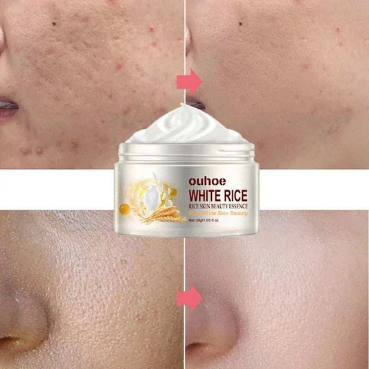 Rice anti-wrinkle facial cream for acne, melasma, pigmentation whitening; face lifting moisturizer, Korean cosmetics 30g.