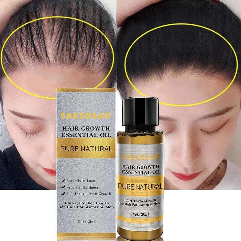 Haarpflege Haarwachstum Ätherische Öle - Anti-Haarausfall Serum-VividBella